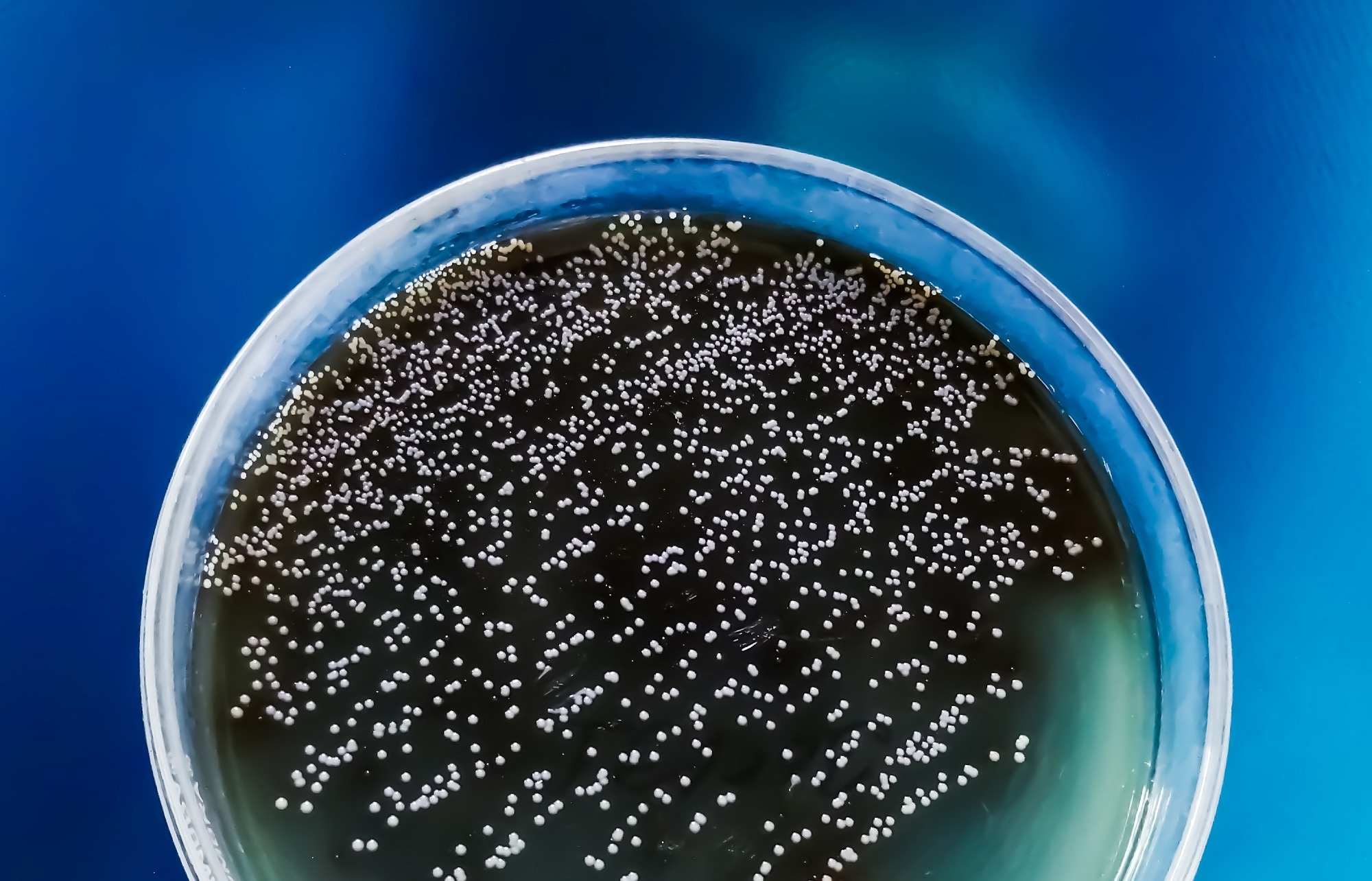 Study: A probiotic nanozyme hydrogel regulates vaginal microenvironment for Candida vaginitis therapy. Image Credit: Saiful52 / Shutterstock.com