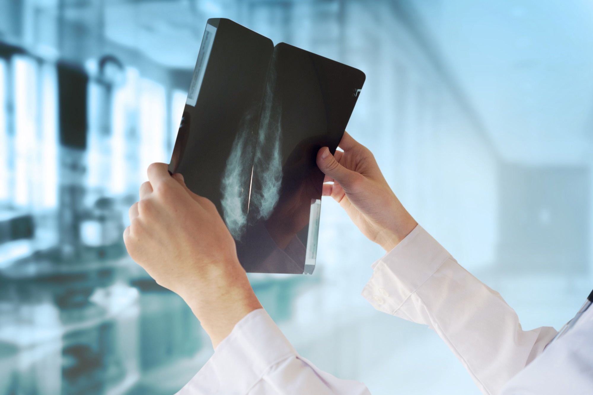 Study: Identification of fatty acid amide hydrolase as a metastasis suppressor in breast cancer. Image Credit: Guschenkova/Shutterstock.com