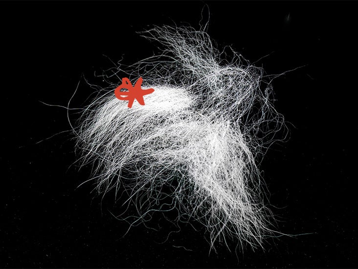 Maladie cardiovasculaire : comment une hormone du stress présente dans les cheveux peut aider à prédire les risques