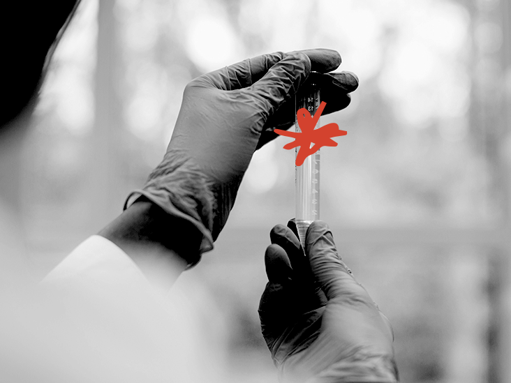 Maladie rénale : comment l'urine et les tests sanguins peuvent aider à prédire la progression