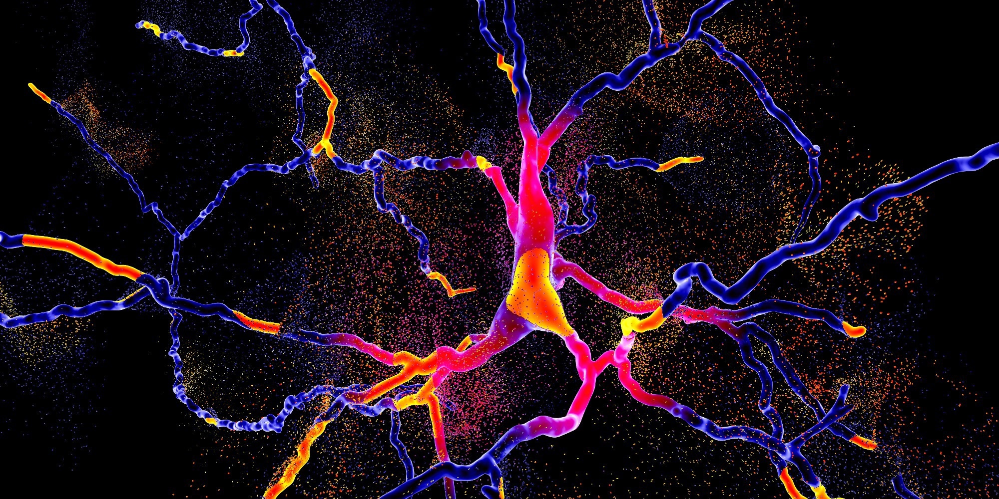 Study: The Endotoxin Hypothesis of Parkinson