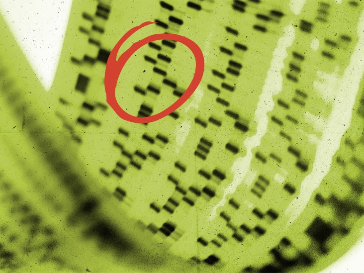 Une nouvelle thérapie génique pourrait-elle aider à inverser la maladie d'Alzheimer ?