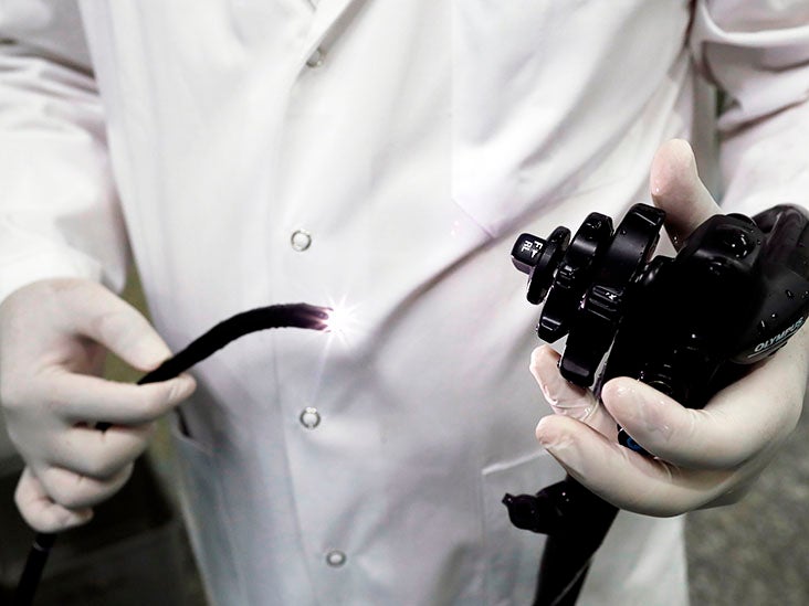 Une procédure endoscopique d'une heure pourrait éliminer le besoin d'insuline pour le diabète de type 2