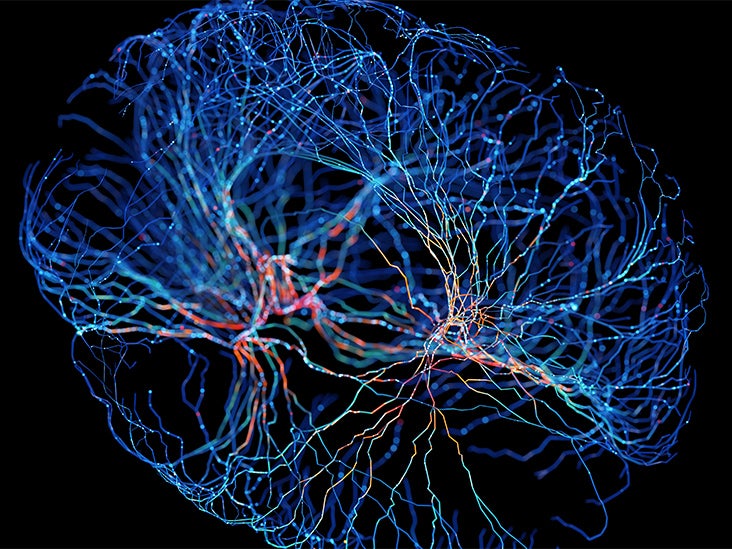 La stimulation transcrânienne pourrait-elle réduire les lésions cérébrales après un AVC ?