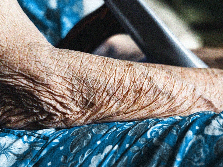 Comment le sommeil pourrait-il affecter le risque d'Alzheimer ?