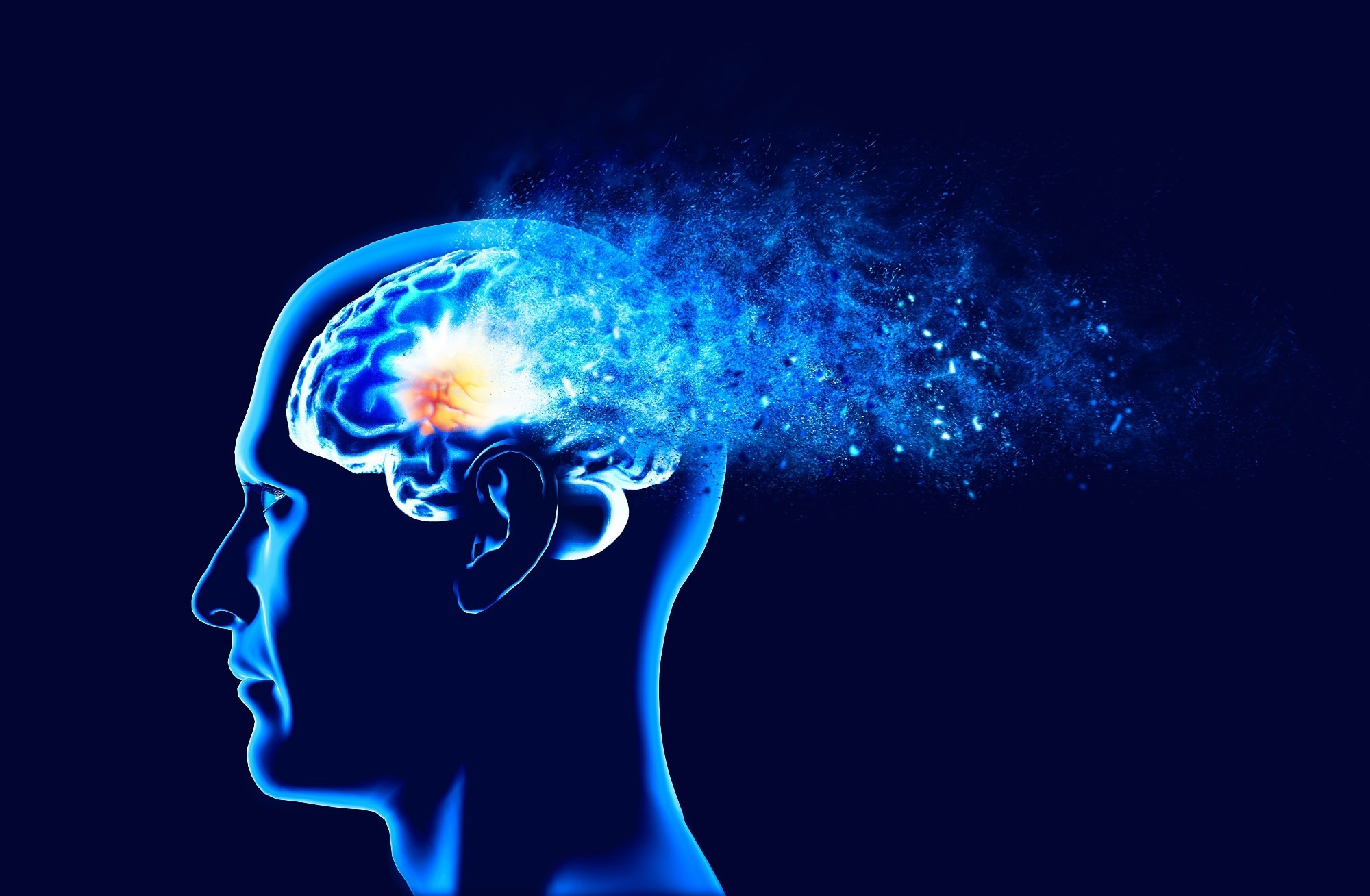 Study: New cases of dementia are rising in elderly populations in Wales, UK. Image Credit: Naeblys / Shutterstock.com