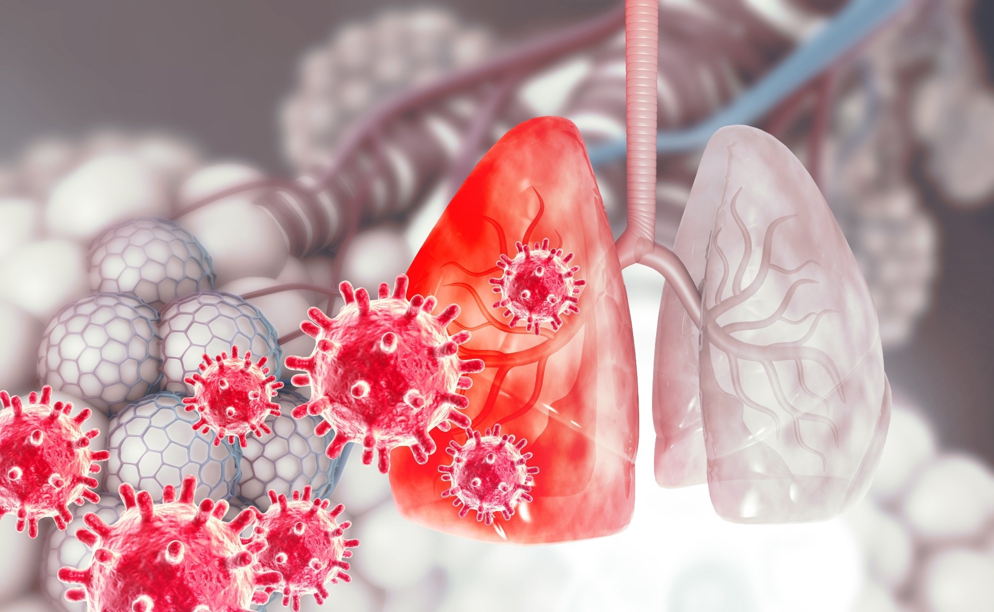Study: Viral respiratory infections in a rapidly changing climate: The need to prepare for the next pandemic. Image Credit: crystal light / Shutterstock.com