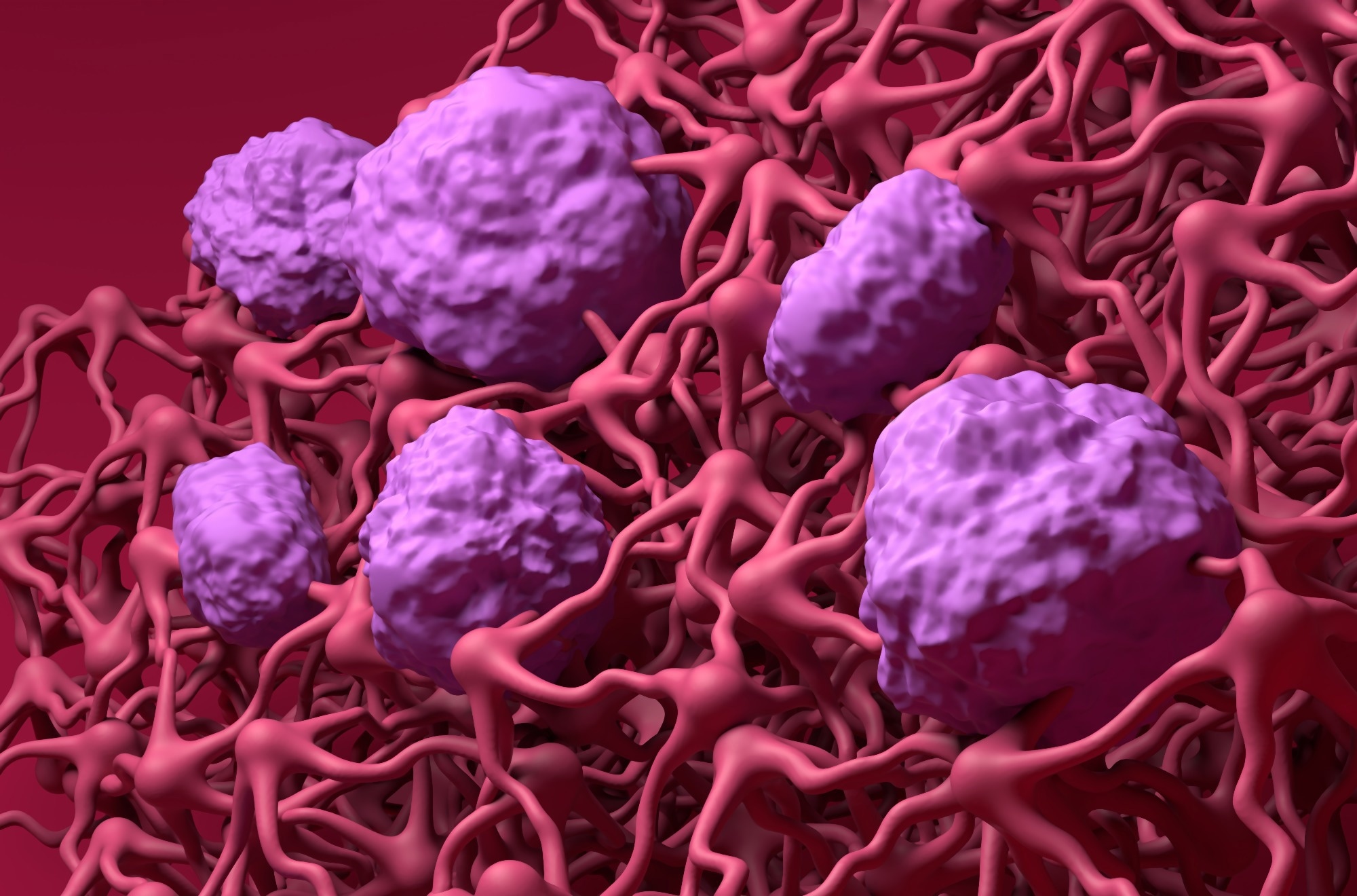 Invasion des cellules immunitaires activée par la rupture de la barrière hémato-encéphalique