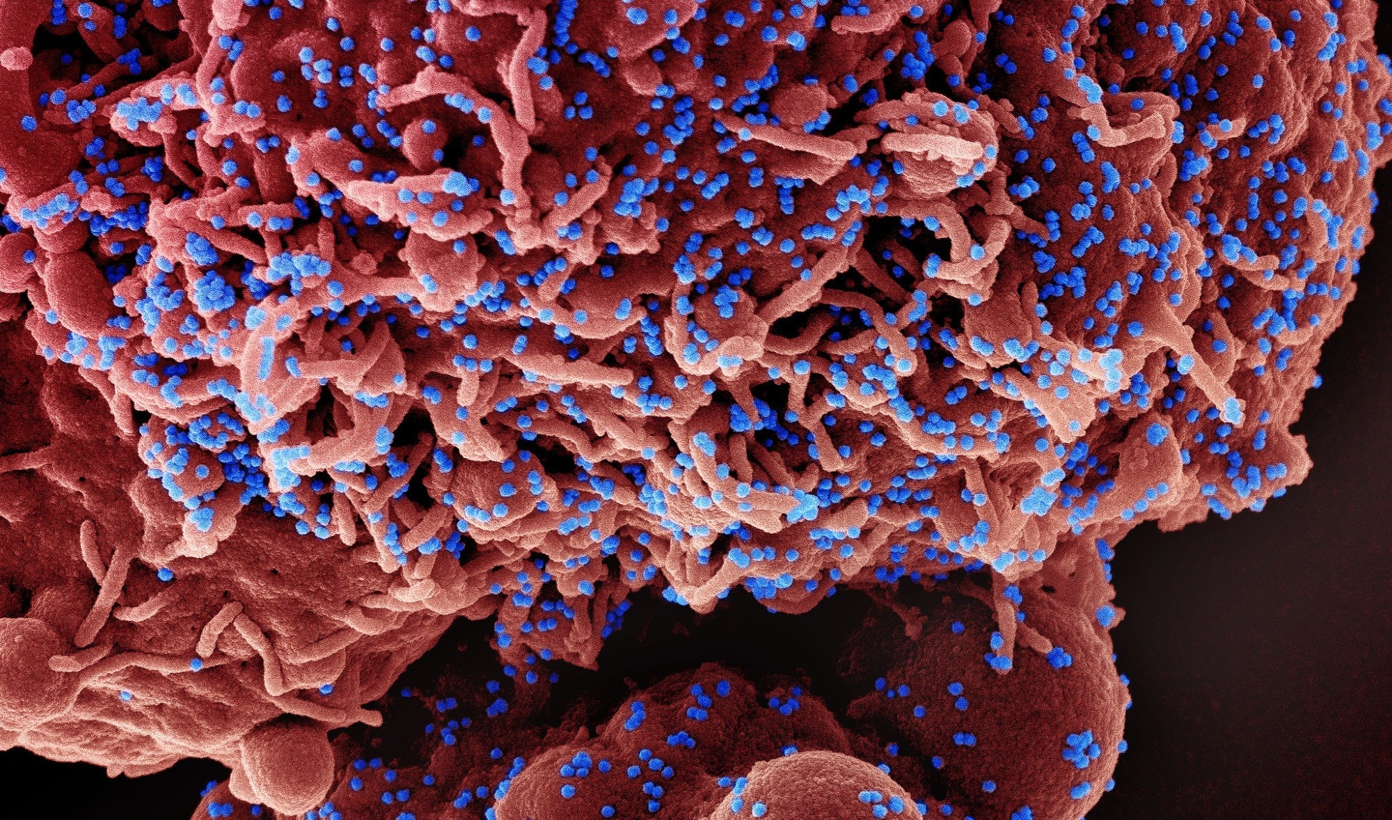 Study: Metabolic alterations upon SARS-CoV-2 infection and potential therapeutic targets against coronavirus infection. Image Credit: NIAID