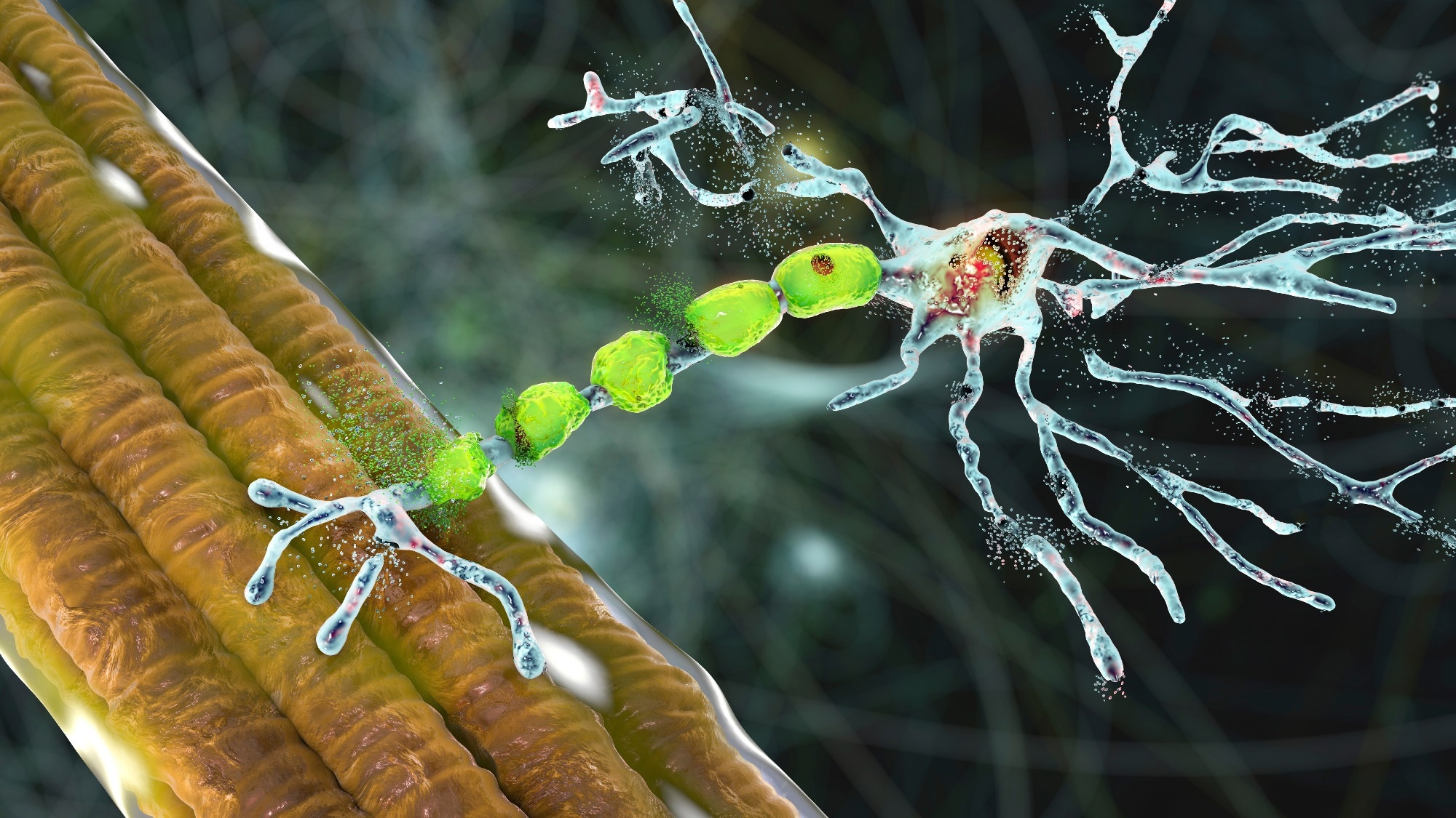 Study: UBQLN2 restrains the domesticated retrotransposon PEG10 to maintain neuronal health in ALS. Image Credit: Kateryna Kon / Shutterstock