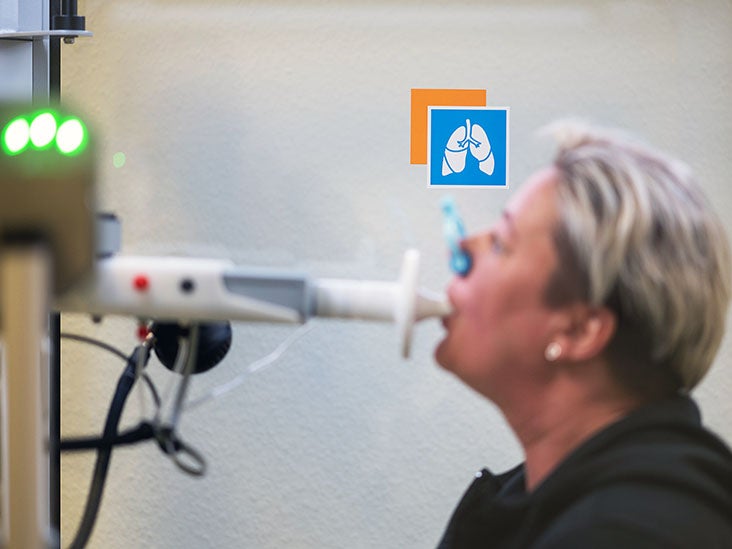 Le long COVID peut avoir un impact sur la qualité de vie pire que le cancer, d'autres maladies