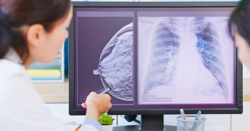Study: Combining machine learning with Cox models to identify predictors for incident post-menopausal breast cancer in the UK Biobank. Image Credit: aslysun / Shutterstock.com