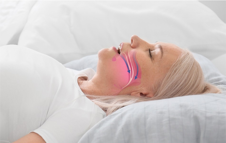 Study: Association of Sleep-Disordered Breathing and Medial Temporal Lobe Atrophy in Cognitively Unimpaired Amyloid-Positive Older Adults. Image Credit: Pixel-Shot/Shutterstock.com