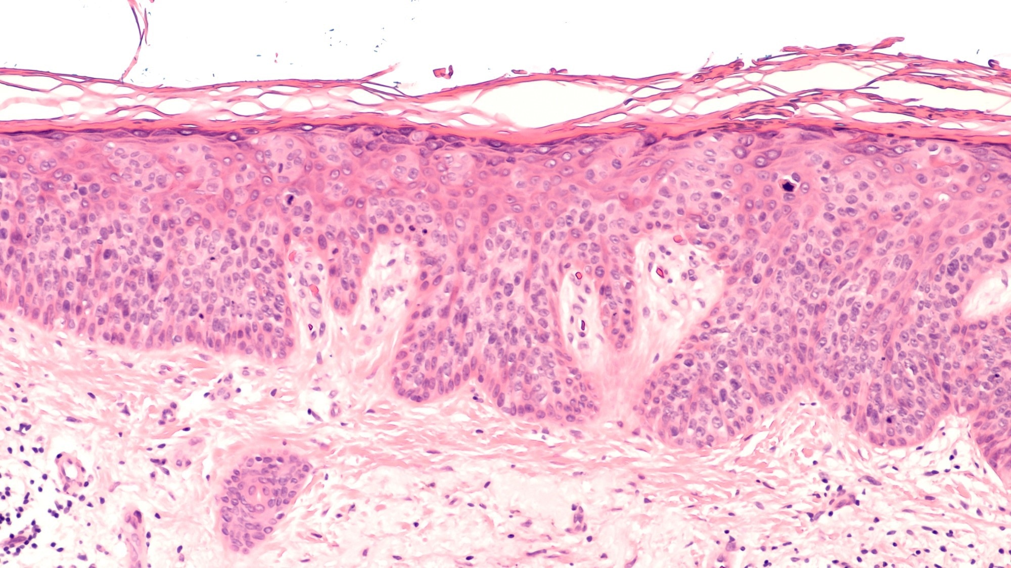 Study: Microfibril-associated protein 5 and the regulation of skin scar formation. Image Credit: David A Litman / Shutterstock.com