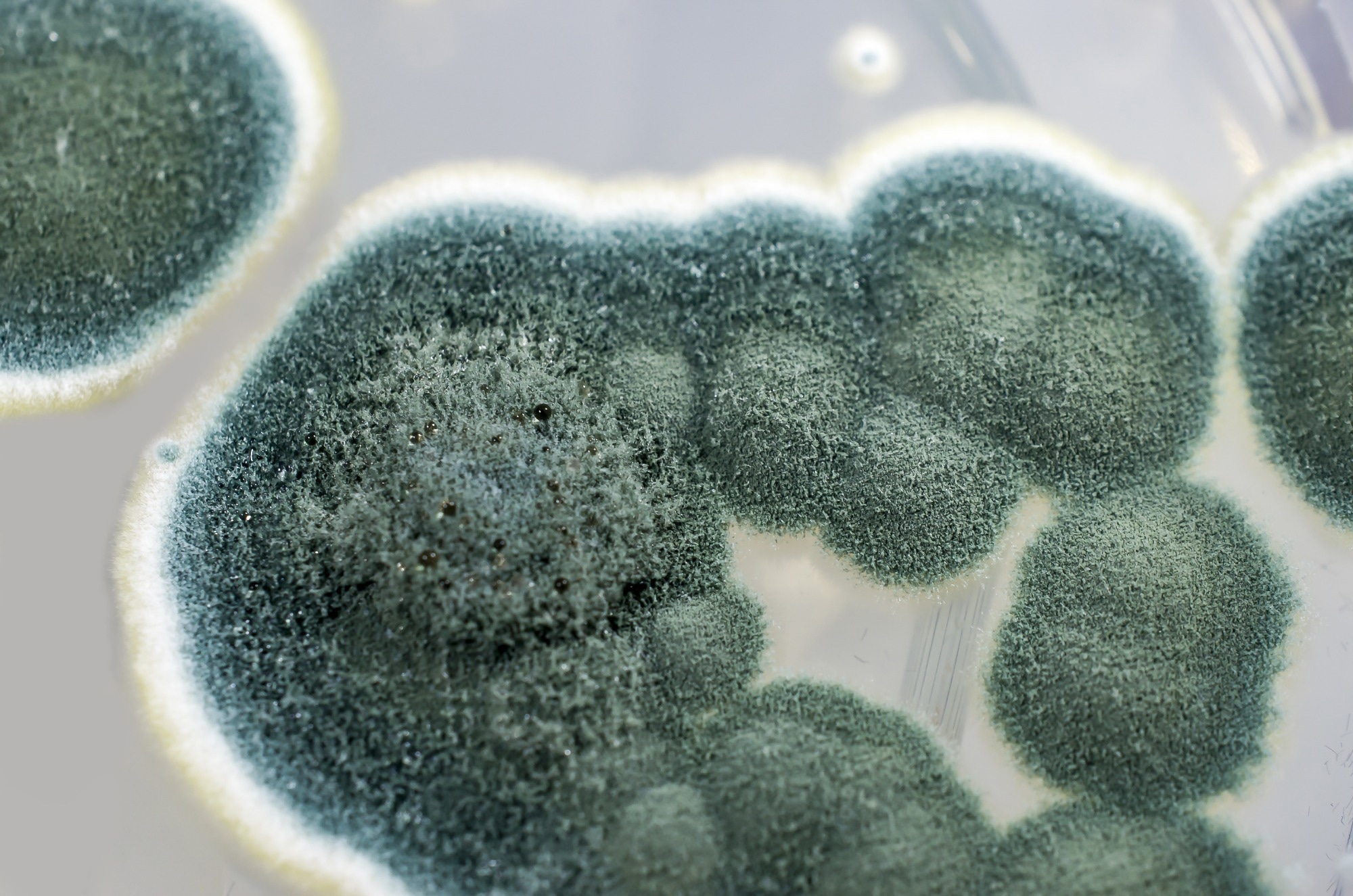 Study: Exploring the antimicrobial, antioxidant, anticancer, biocompatibility, and larvicidal activities of selenium nanoparticles fabricated by endophytic fungal strain Penicillium verhagenii. Image Credit: KaterynaKon/Shutterstock.com