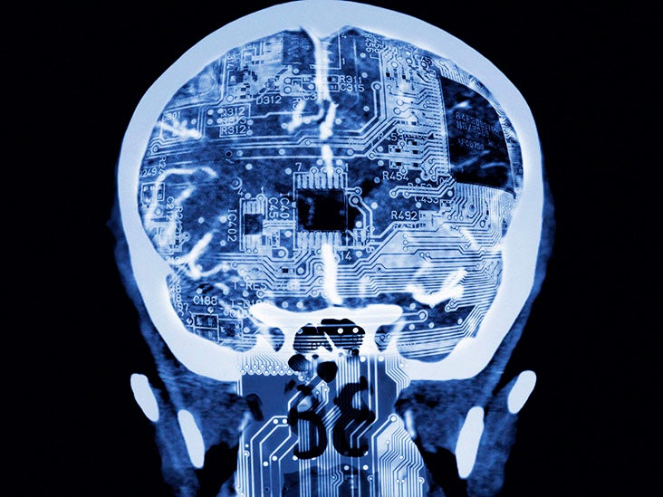 Épilepsie : une nouvelle cartographie du cerveau peut aider à contrôler les symptômes