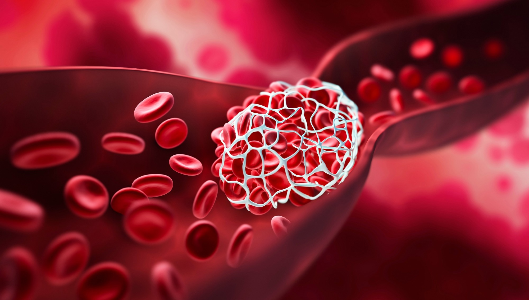Study: Generation of potentially inhibitory autoantibodies to ADAMTS13 in coronavirus disease 2019. Image Credit: peterschreiber.media / Shutterstock.com