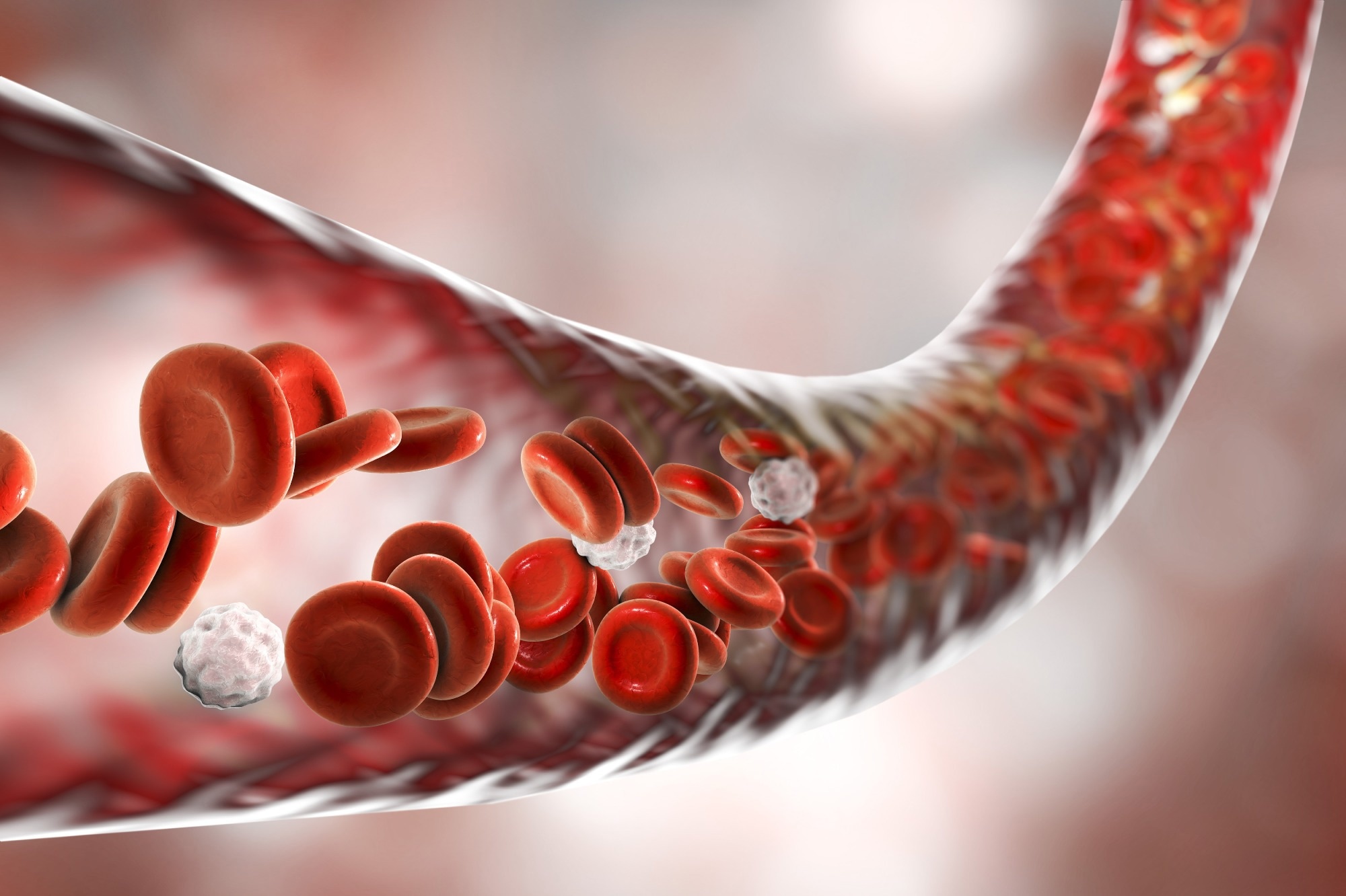 La valeur pronostique des niveaux de PCSK9 pour prédire les événements cardiovasculaires indésirables majeurs et la mortalité chez les diabétiques