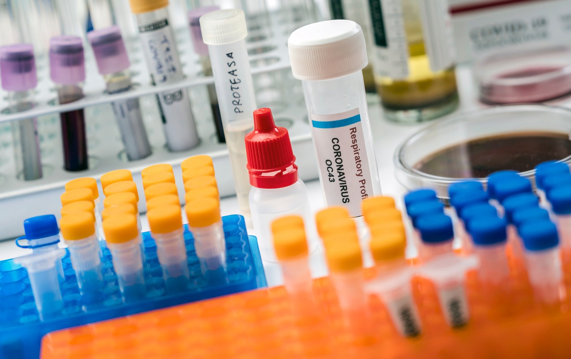 Study: Activation of SARS-CoV-2 by trypsin-like proteases in the clinical specimens of patients with COVID-19. Image Credit: felipecaparros/Shutterstock.com