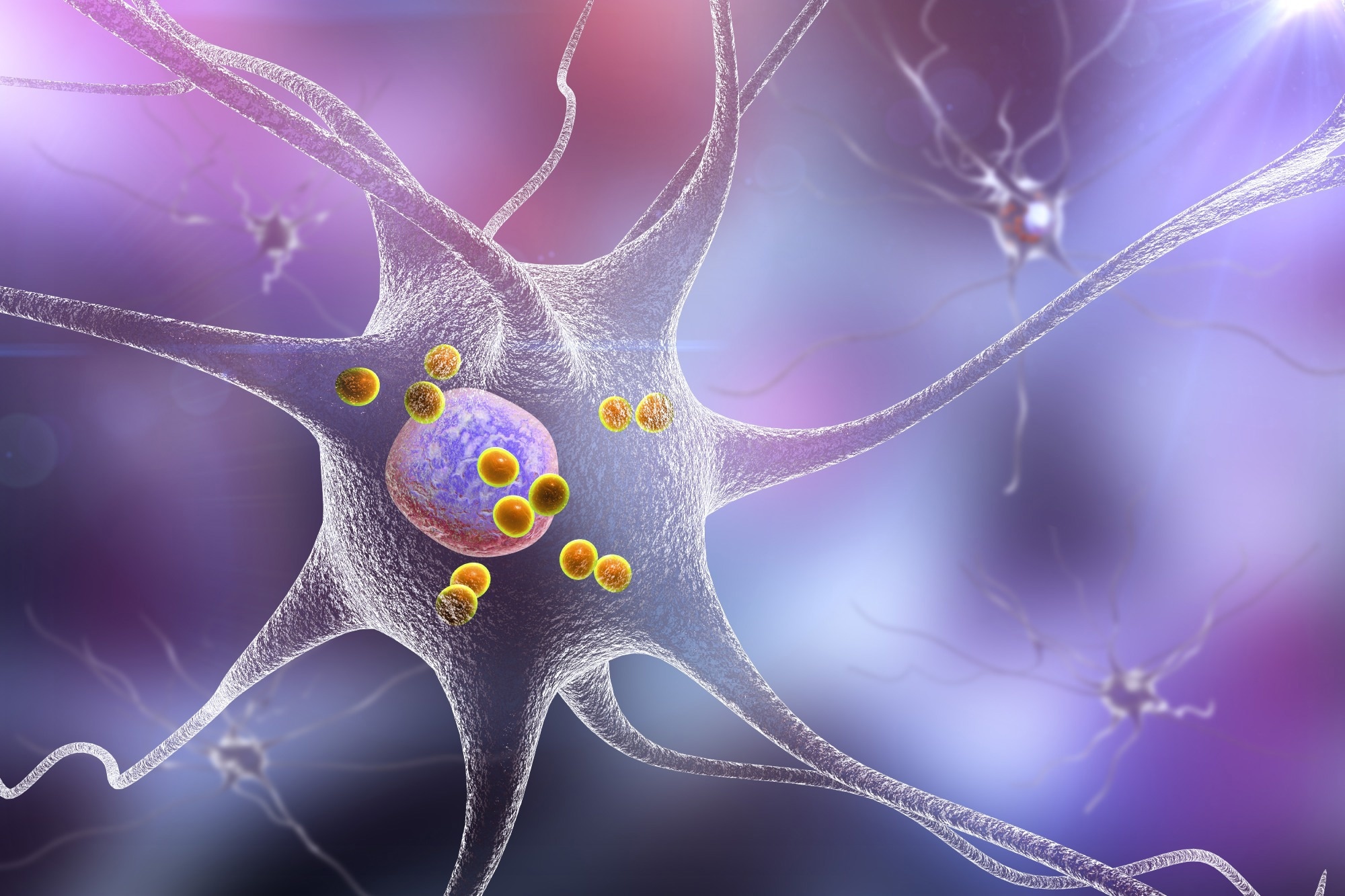 Study: Cognitive effects of Lewy body pathology in clinically unimpaired individuals. Image Credit: KaterynaKon/Shutterstock.com