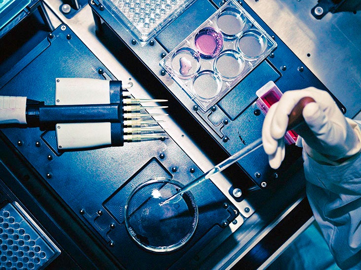 Un nouveau biocapteur pourrait-il être l'avenir du diagnostic de la maladie de Parkinson et d'Alzheimer ?