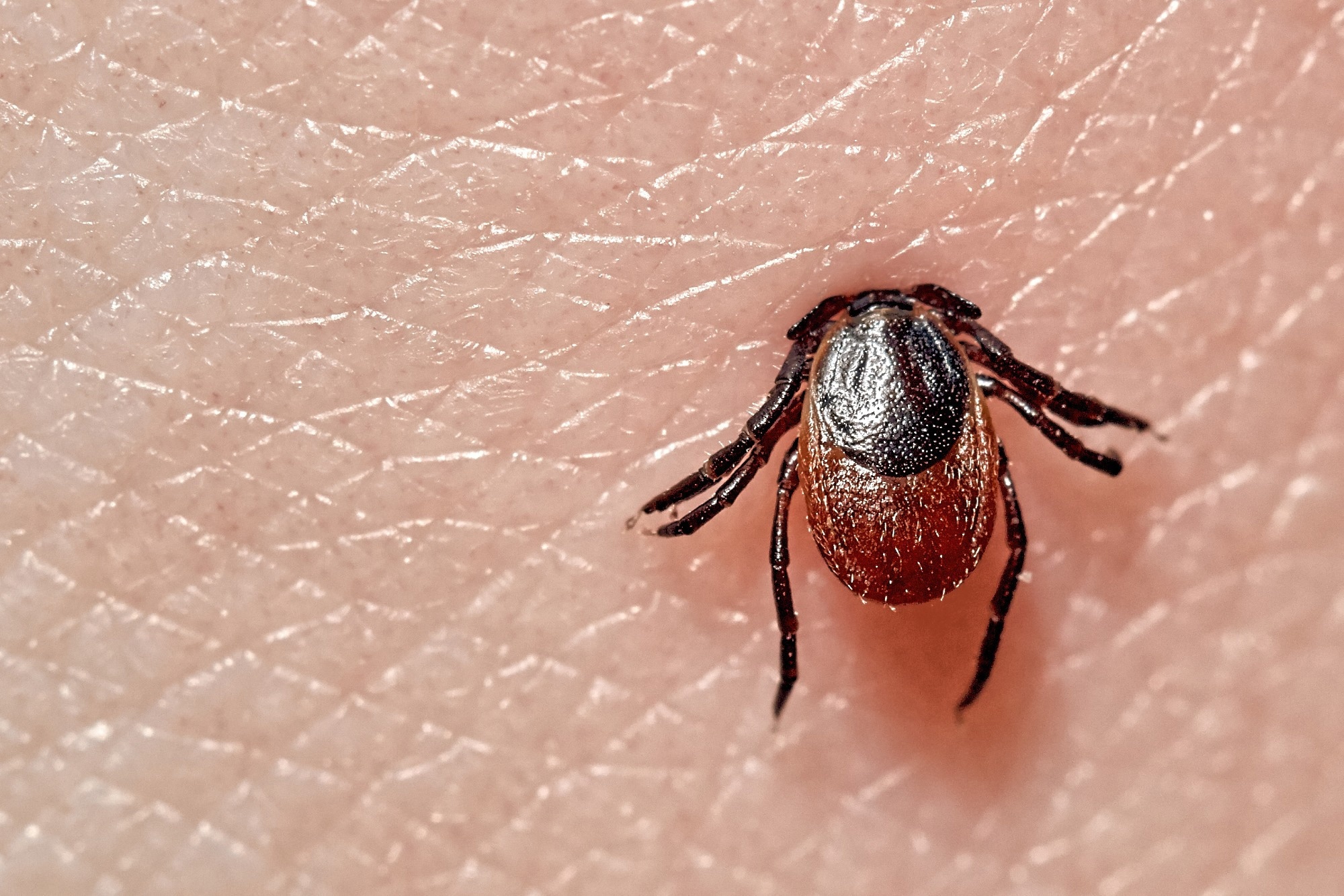 Un nouveau vaccin contre la maladie de Lyme serait sûr et efficace