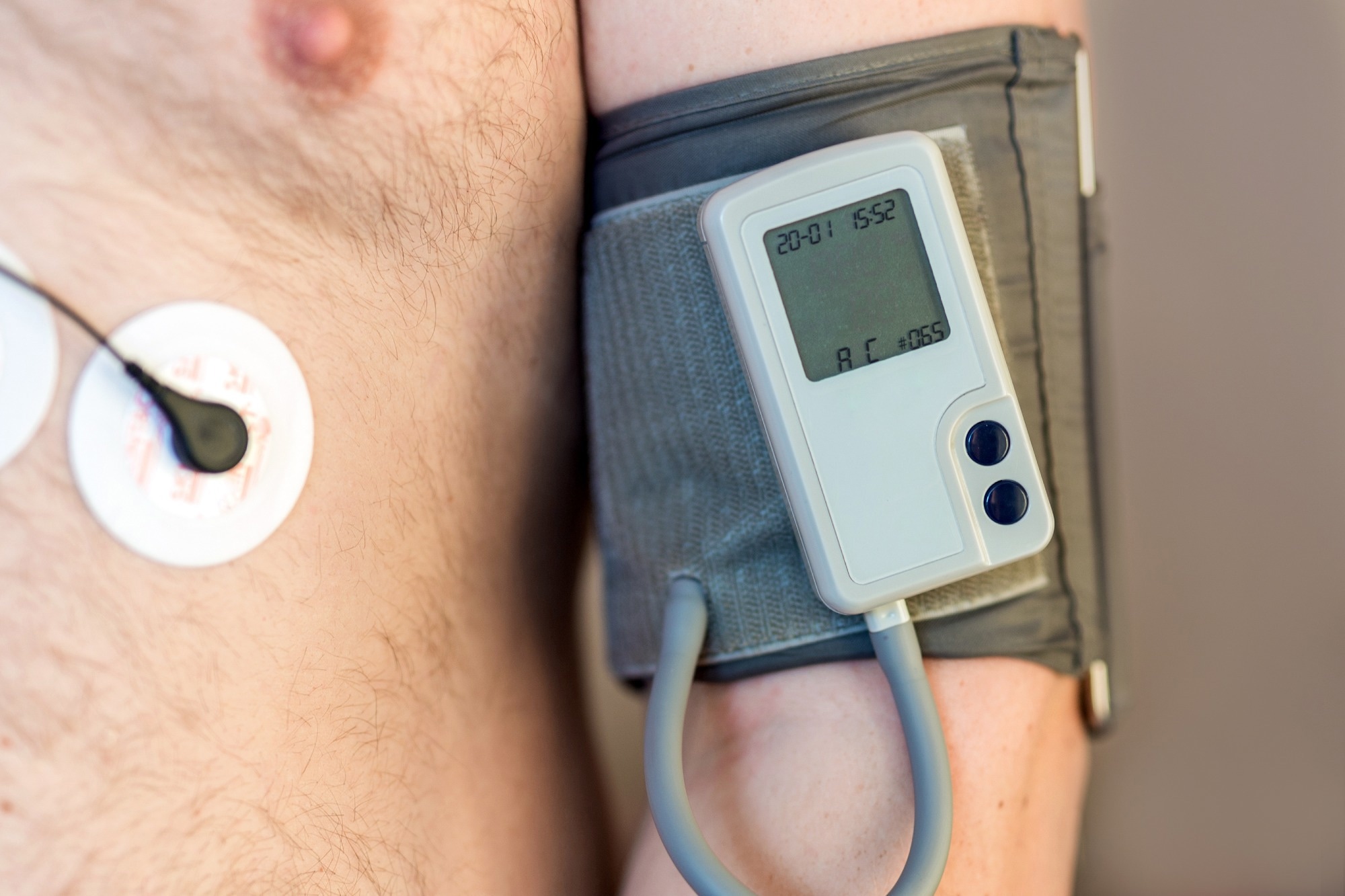 Study: Food consumption by degree of processing is associated with nocturnal dipping and blood pressure variability: The ELSA-Brasil study. Image Credit: Gorloff-KV/Shutterstock.com