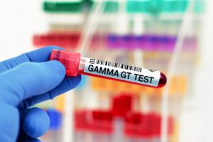 Comment faire baisser les gamma GT en 5 jours ?