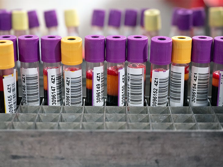 Des niveaux élevés de protéines de crise cardiaque peuvent augmenter le risque de décès de 76%