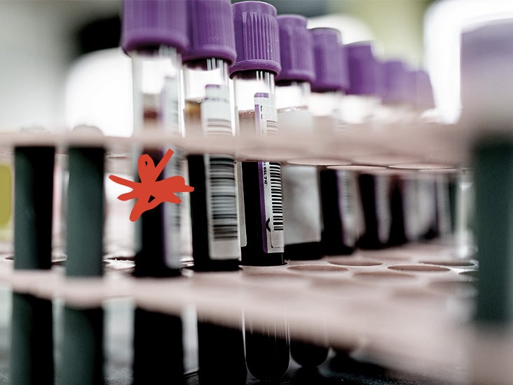 Le test d'Alzheimer à domicile disponible dans le commerce pourrait aider au diagnostic précoce