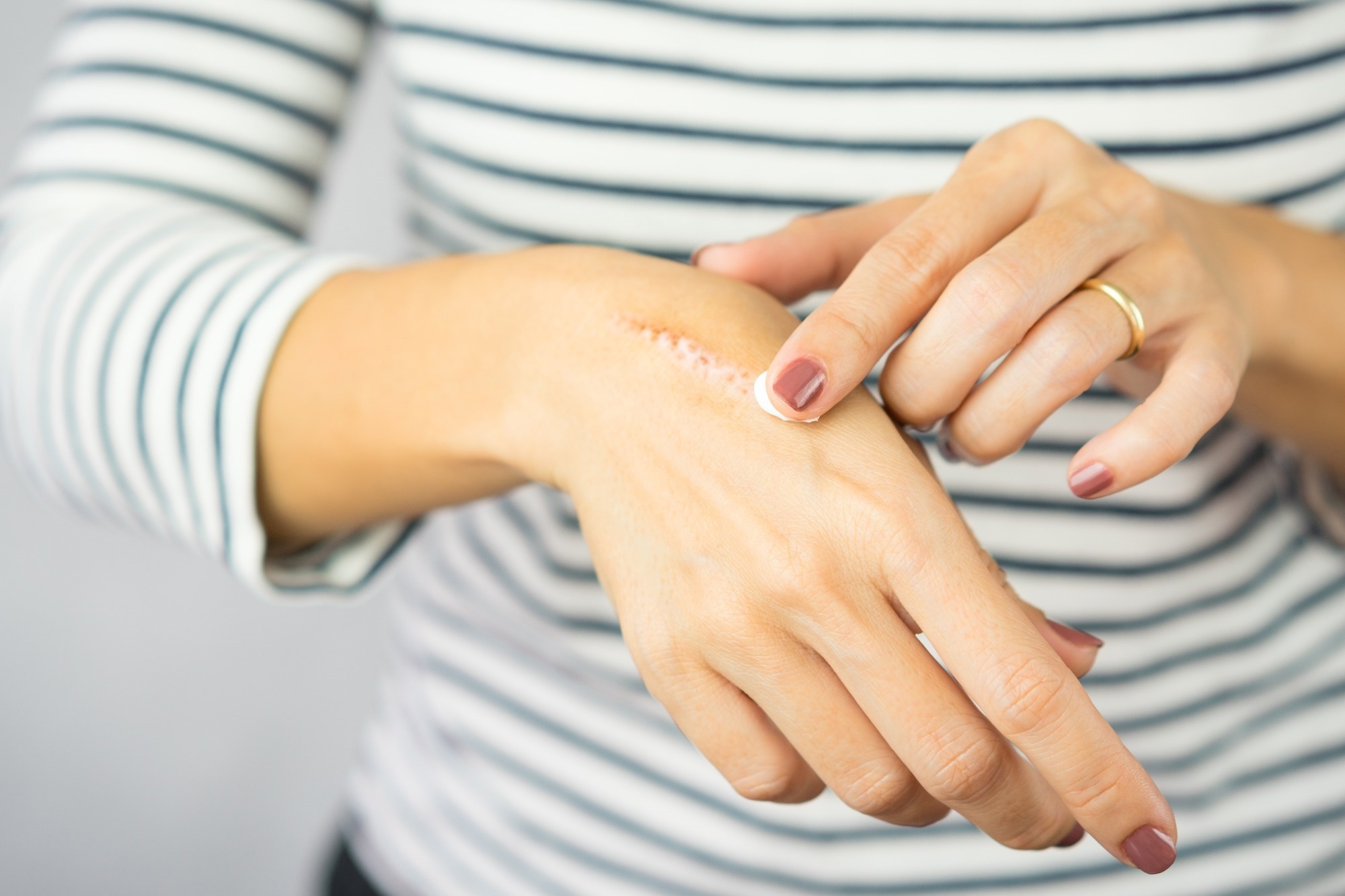 Study: Is my wound infected? A study on the use of hyperspectral imaging to assess wound infection. Image Credit: myboys.me / Shutterstock.com
