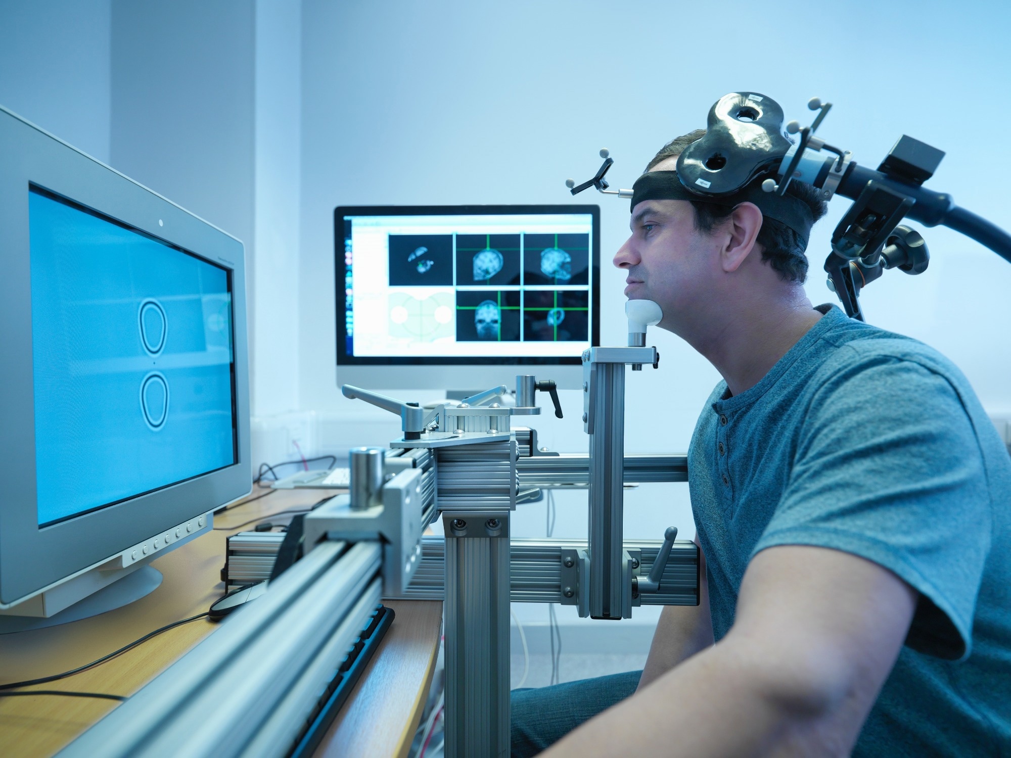 Robotic transcranial magnetic stimulation in the treatment of depression: a pilot study