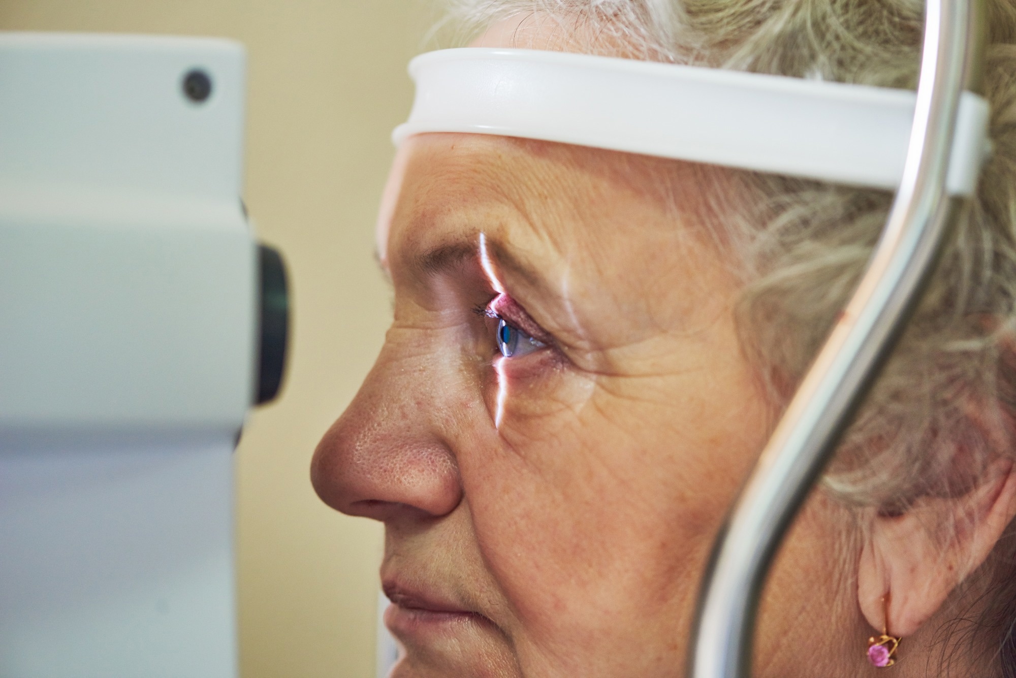 Retinal Optical Coherence Tomography Features Associated With Incident and Prevalent Parkinson Disease