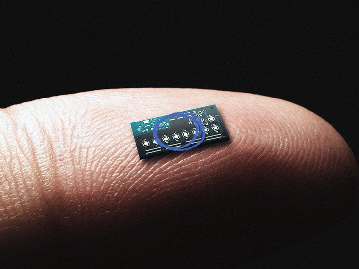 Une micropuce reliant le cerveau et le corps aide un homme paralysé à retrouver le mouvement du bras