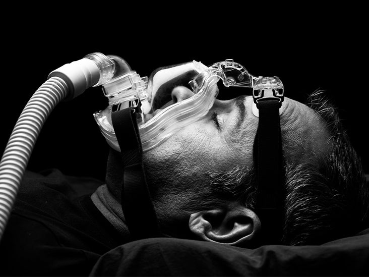 L’utilisation d’un CPAP peut réduire le risque de mortalité due aux maladies cardiaques liées à l’apnée du sommeil