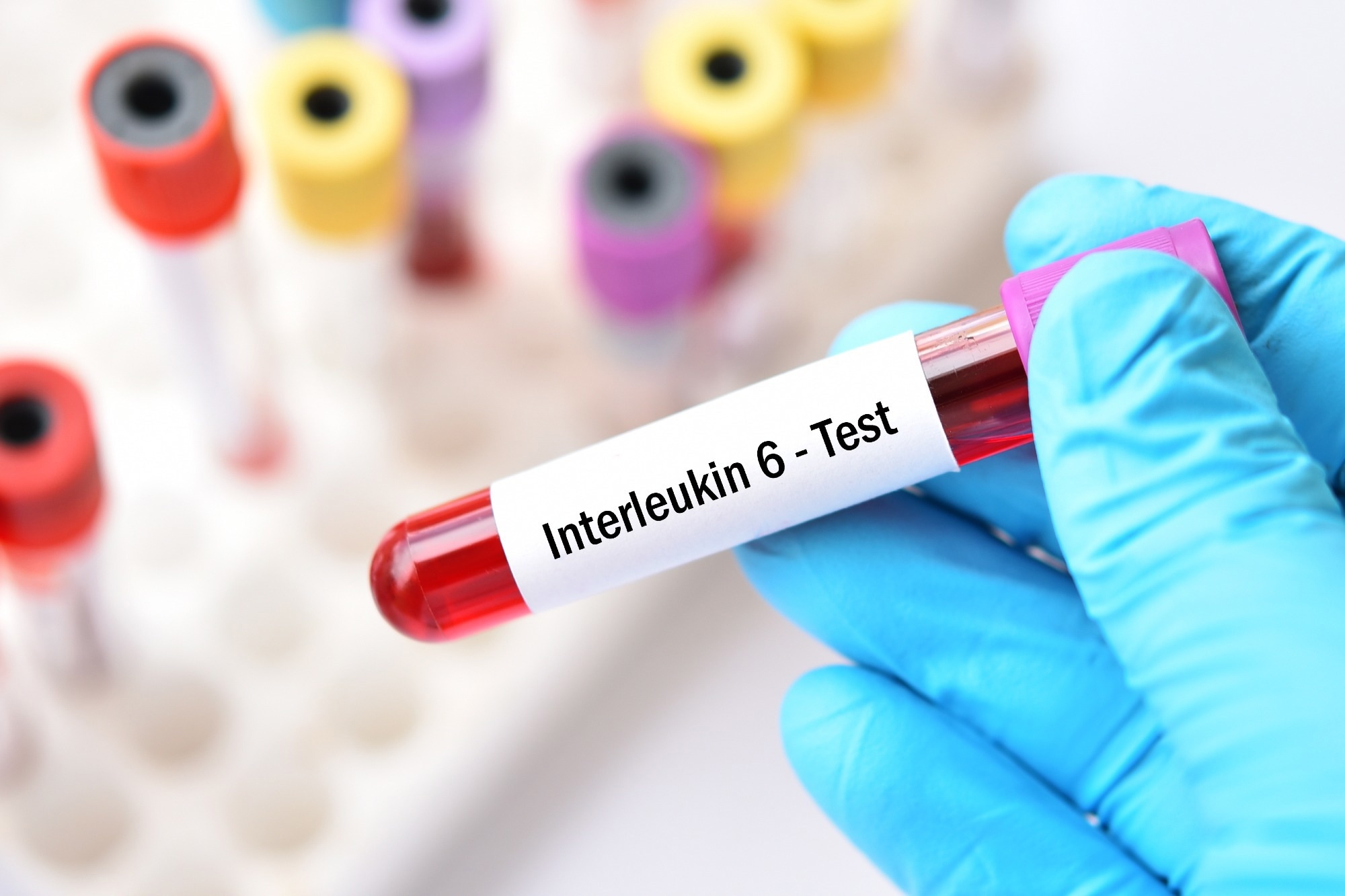 Discovery of a selective and biologically active low-molecular weight antagonist of human interleukin-1β