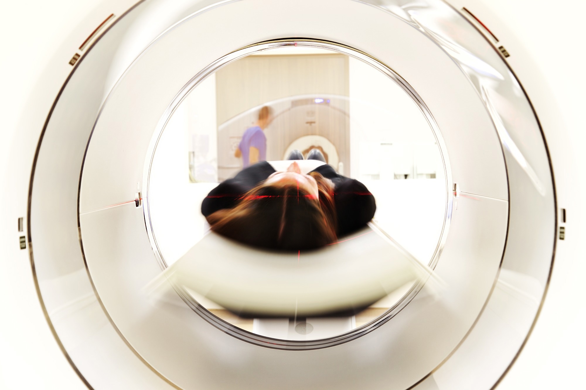L’apprentissage profond révolutionne l’IRM cérébrale à champ ultra faible pour des analyses plus rapides et plus claires