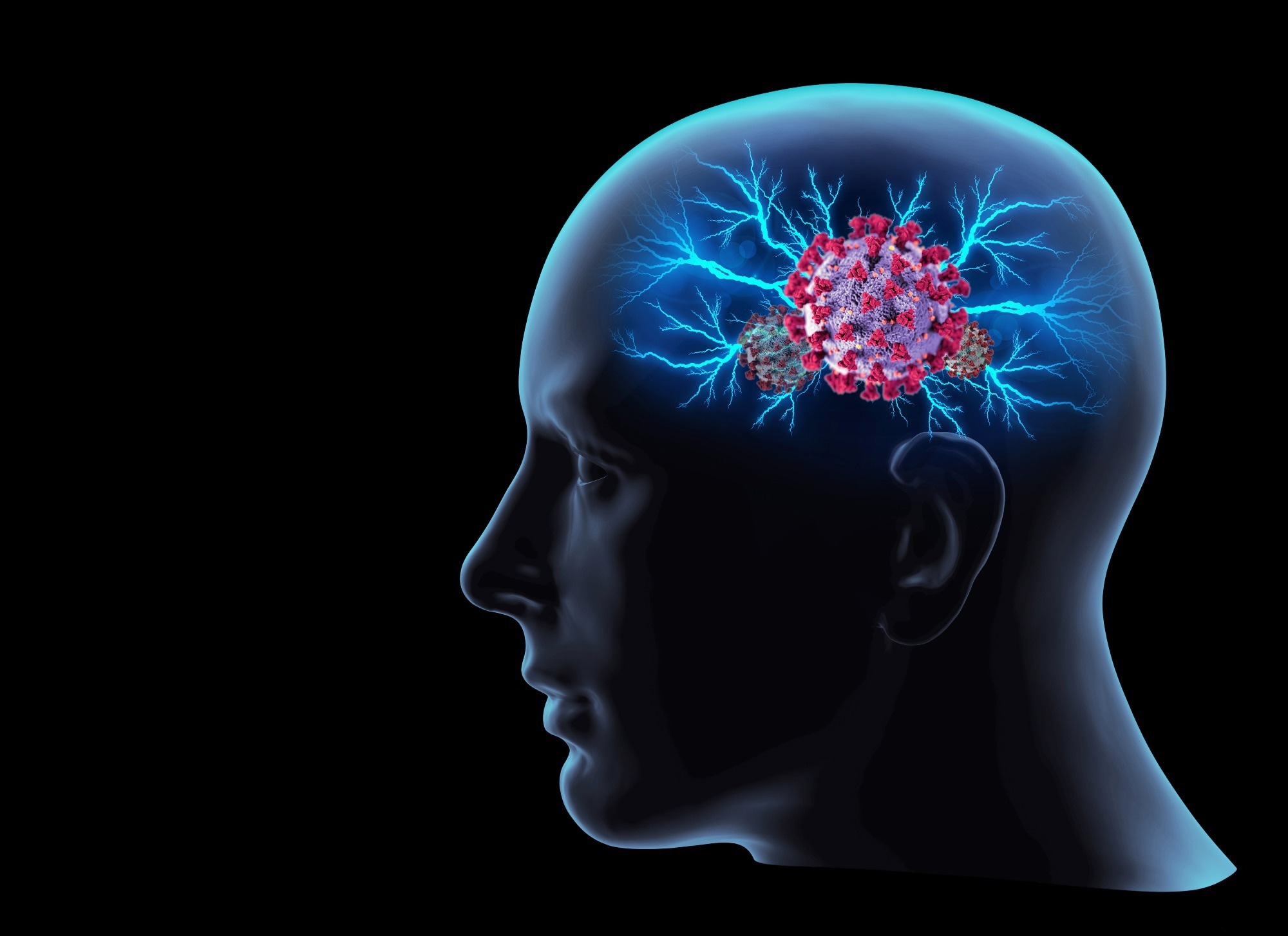 SARS-CoV-2 RNA Persists in the Central Nervous System of Non-Human Primates Despite Clinical Recovery