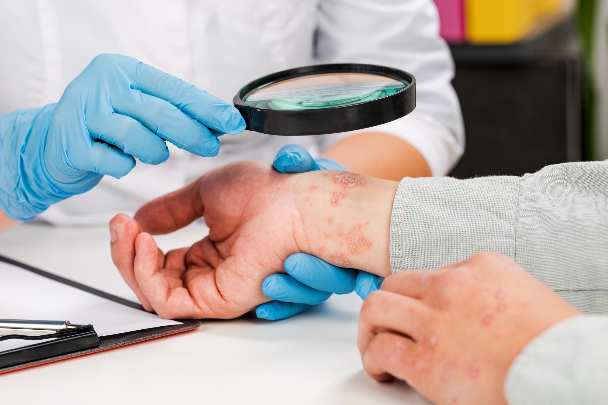 Study: Comparative Study of Hematological Parameters and Biomarkers of Immunity and Inflammation in Patients with Psoriasis and Atopic Dermatitis. Image Credit: Fuss Sergey/Shutterstock.com