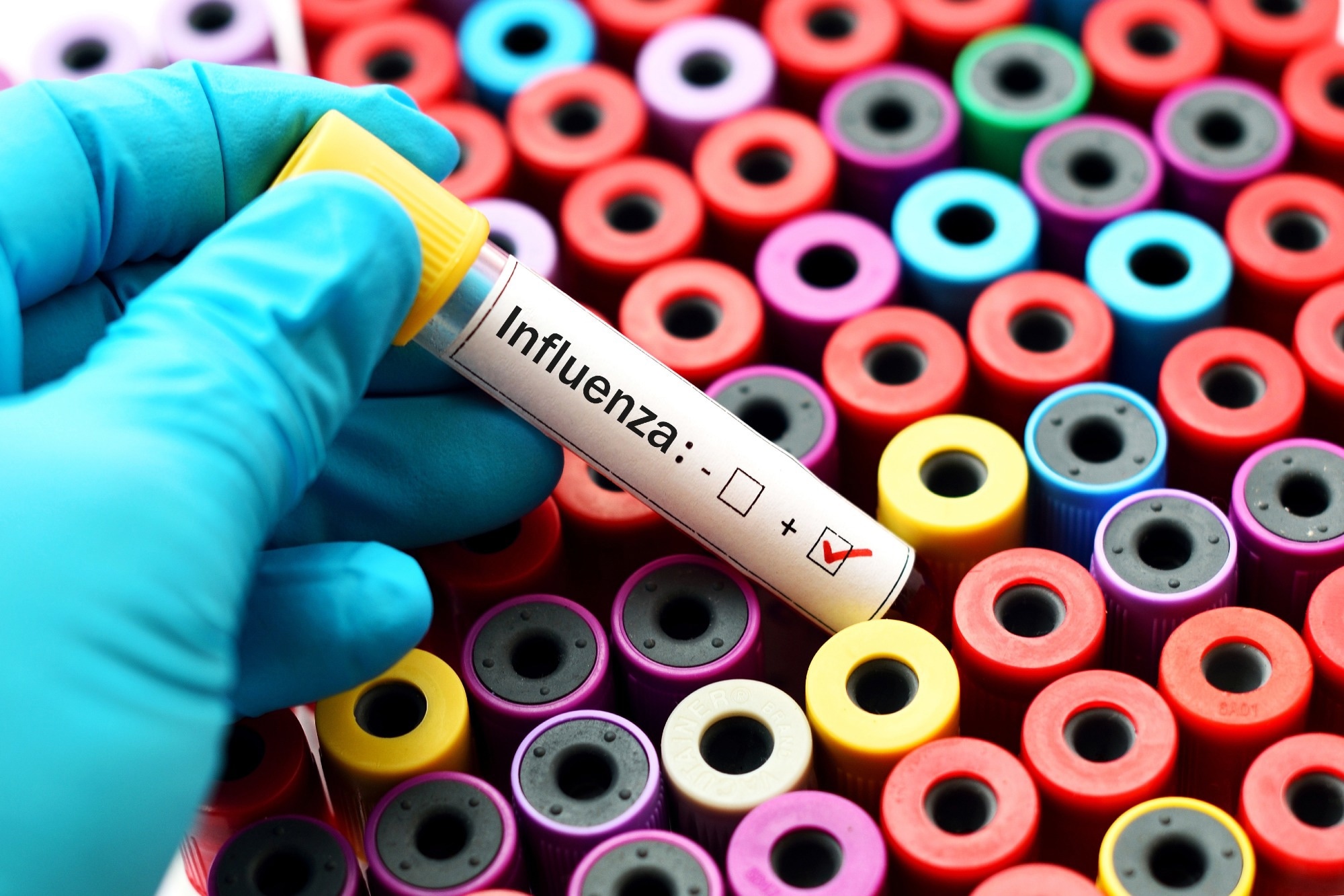 Study: Obesity dysregulates the pulmonary antiviral immune response. Image Credit: Jarun Ontakrai/Shutterstock.com