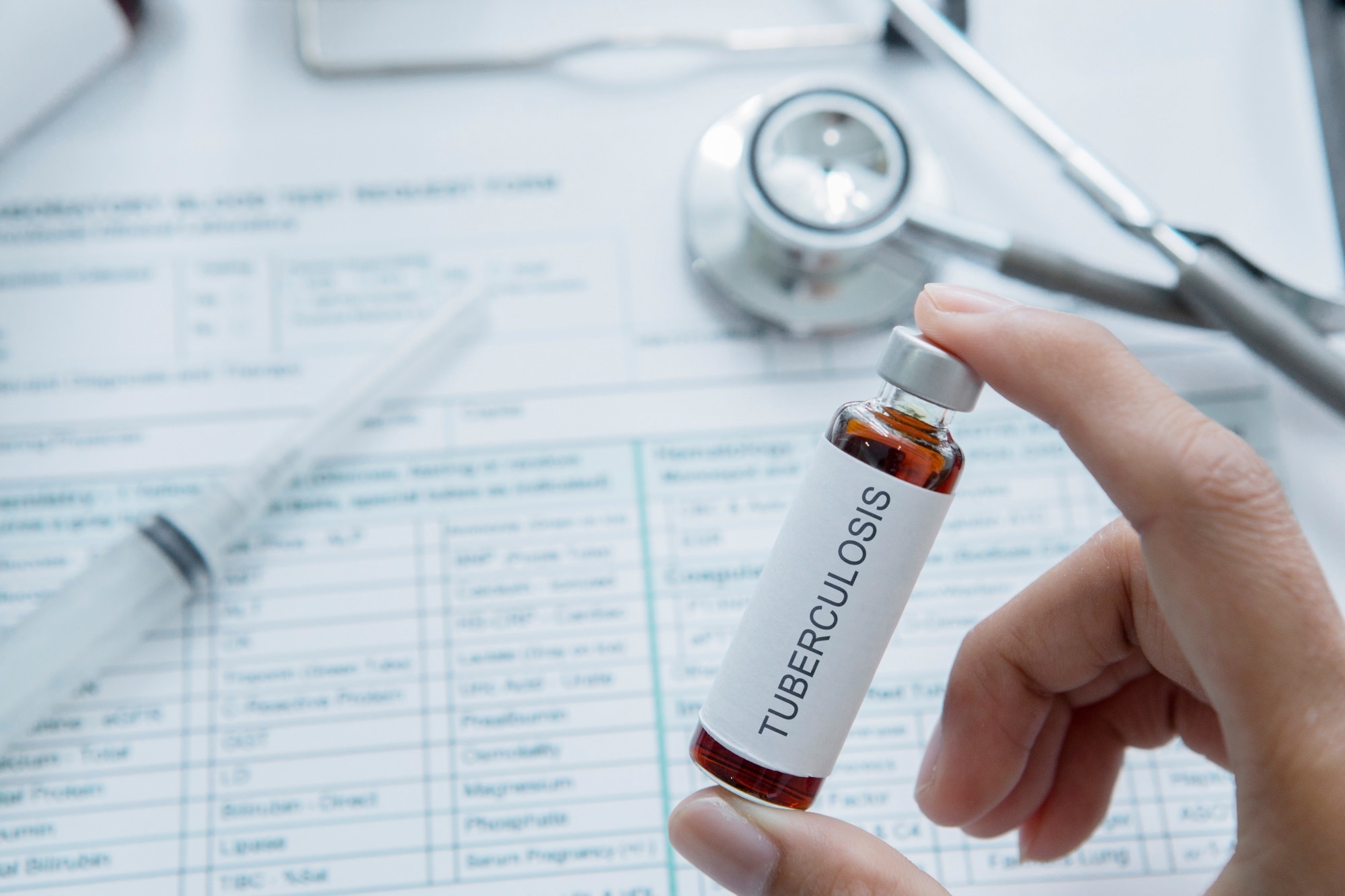 Study: Key advances in vaccine development for tuberculosis—success and challenges. Image Credit: Creativa Images/Shutterstock.com