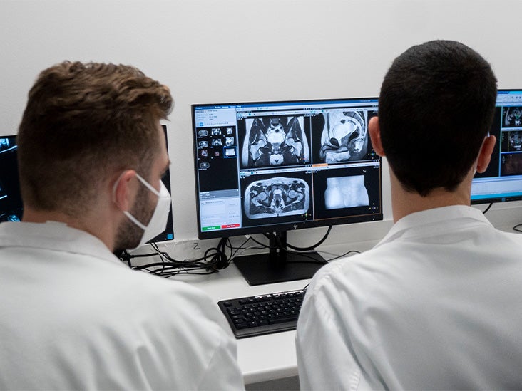 Des doses de radiothérapie plus élevées pour le cancer de la prostate peuvent réduire en toute sécurité le temps d'exposition
