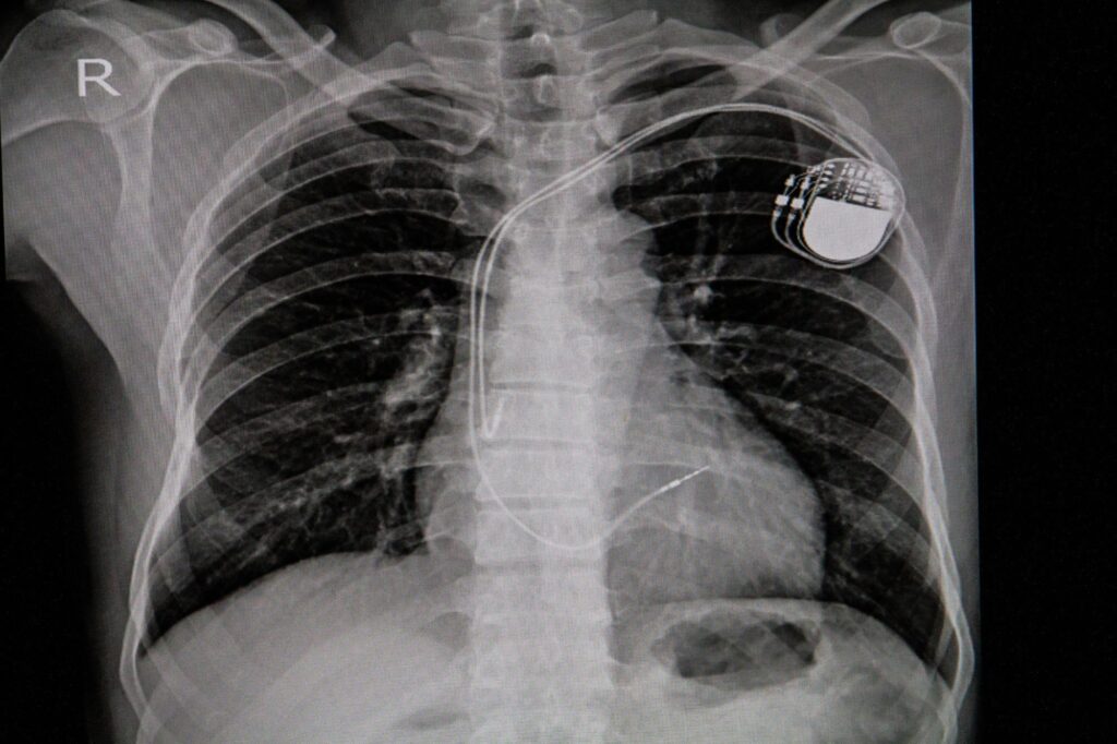 Study: Generative Artificial Intelligence for Chest Radiograph Interpretation in the Emergency Department. Image Credit: April stock / Shutterstock