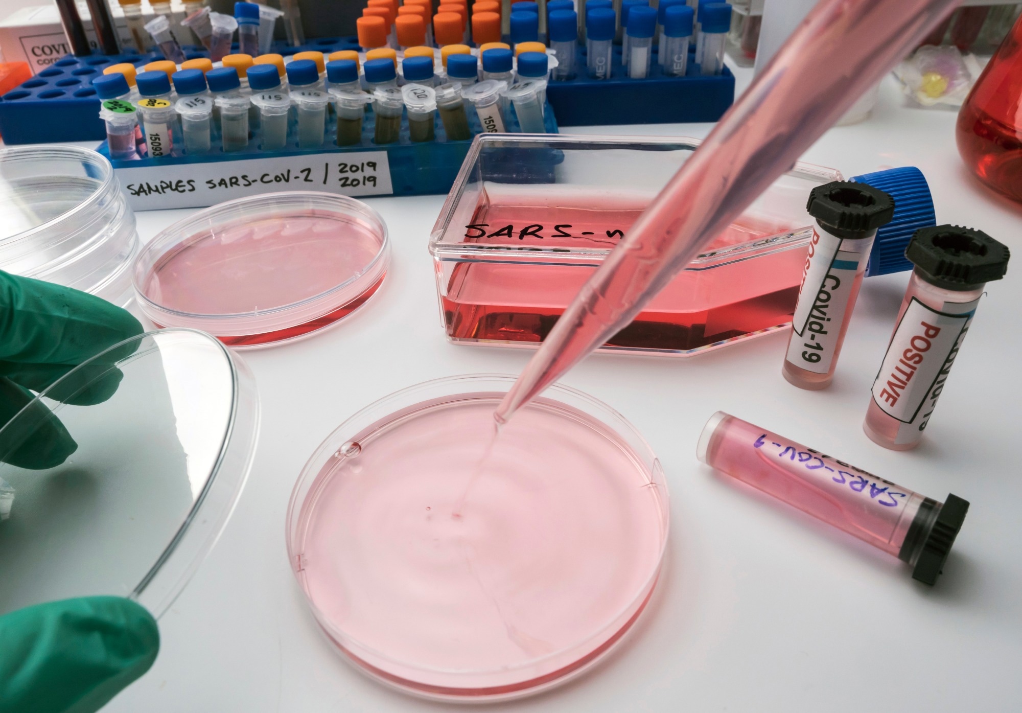 Study: Mapping SARS-CoV-2 antigenic relationships and serological responses. Image Credit: felipe caparros / Shutterstock