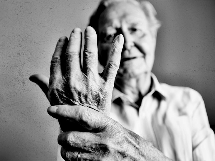 Un médicament courant peut aider à gérer les symptômes et la douleur de l’arthrose
