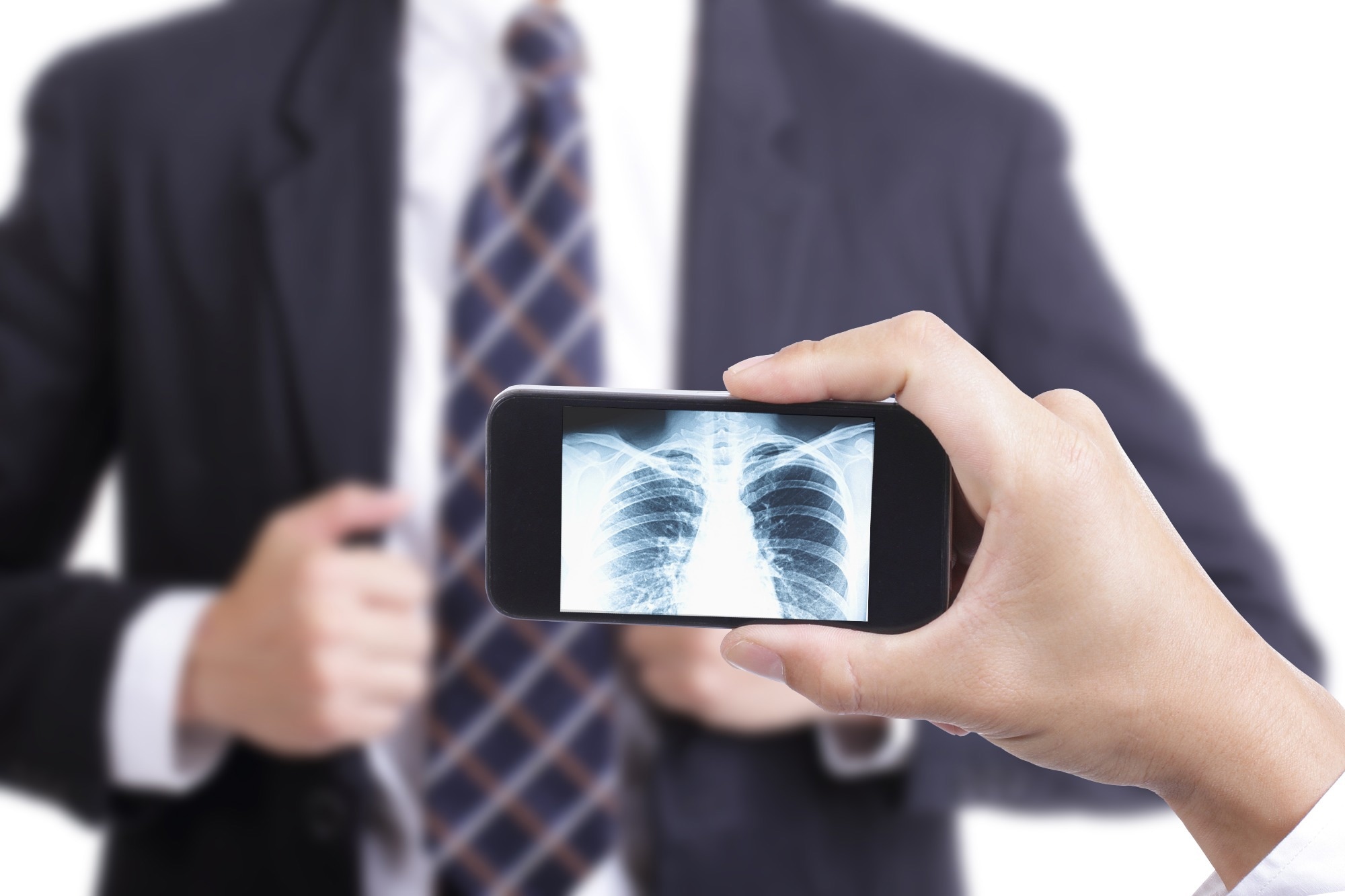 Un nouveau modèle d’IA vise à corriger les failles du diagnostic par rayons X du COVID-19 sur smartphone