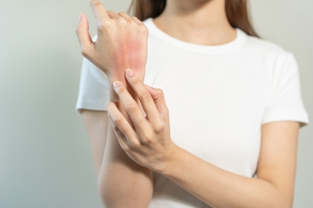 Study: Multifaceted analysis of cross-tissue transcriptomes reveals phenotype–endotype associations in atopic dermatitis. Image Credit: Kmpzzz/Shutterstock.com