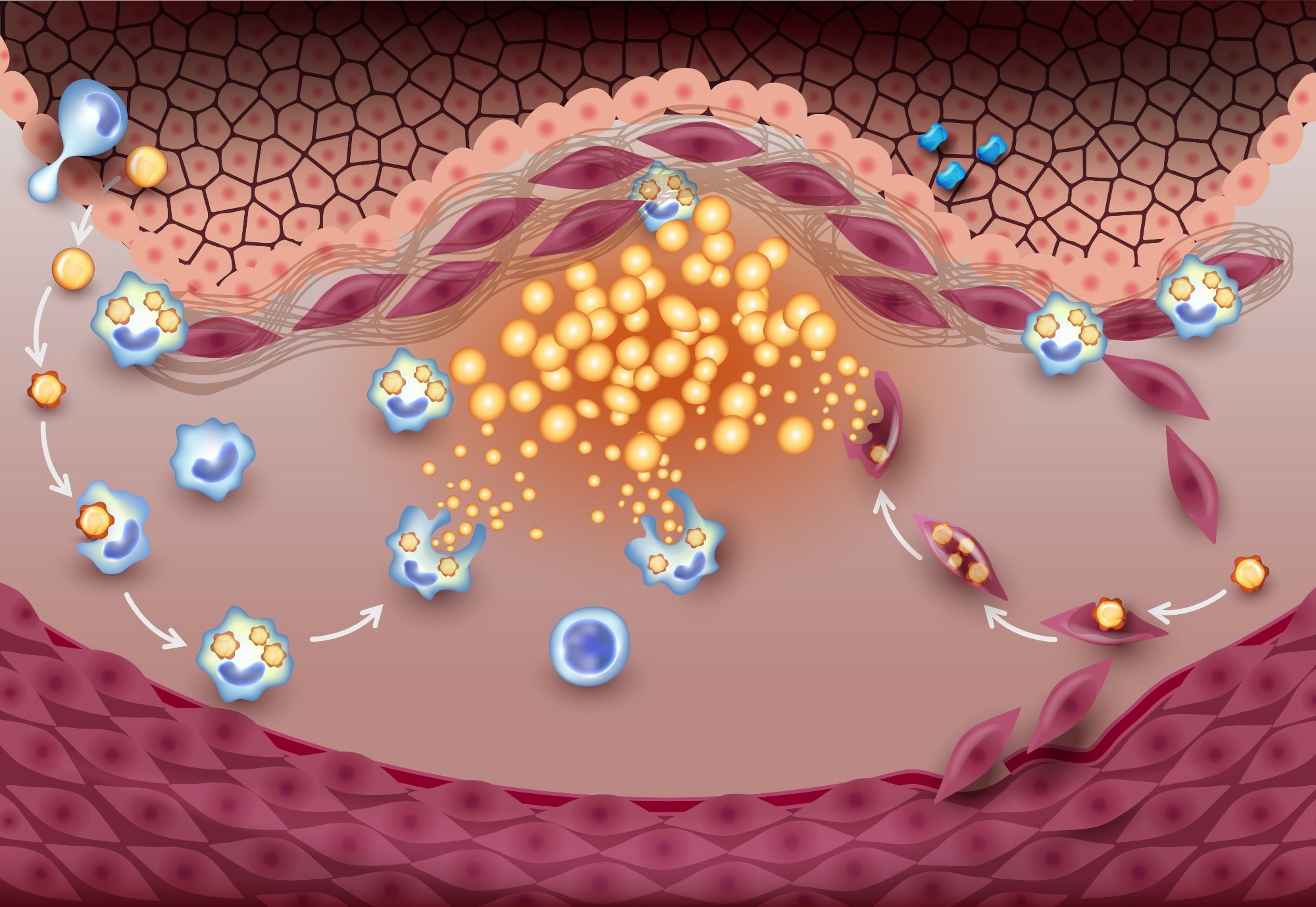 Study: SARS-CoV-2 infection triggers pro-atherogenic inflammatory responses in human coronary vessels. Image Credit: TimeLineArtist / Shutterstock
