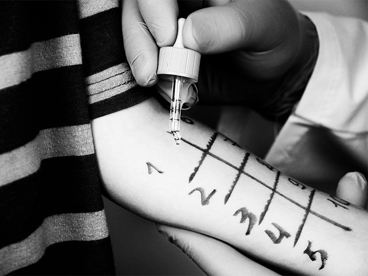 Eczéma : les enfants atteints de dermatite atopique peuvent être plus à risque de développer d'autres affections cutanées