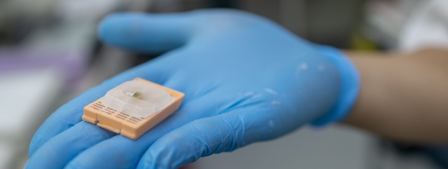 BioEcho présente le kit d'ARN EchoLUTION™ FFPE pour une extraction supérieure de l'ARN des tissus FFPE